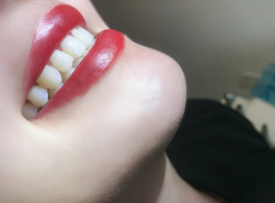 湖南中 医 药大学第二附属医院口腔科特色项目及技术优势