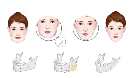 宁波邬立新医疗美容诊所医生团队实力强大及骨干医生简介