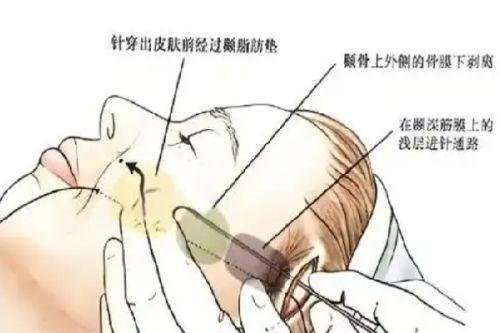 肇庆美创医疗美容门诊部特色项目及技术优势