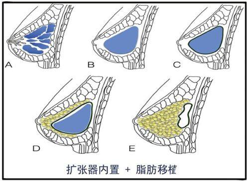 郑州美立方整形美容医院收费价格表/收费标准