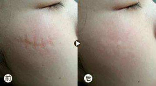 肇庆美创医疗美容门诊部是正规医院吗？