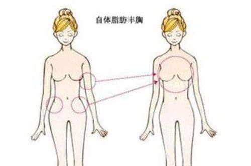 黄峰医生口碑评价及真人实例