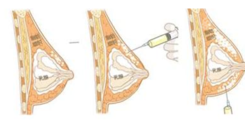 衢州熙妍医疗美容门诊部详细的预约挂号方式及流程