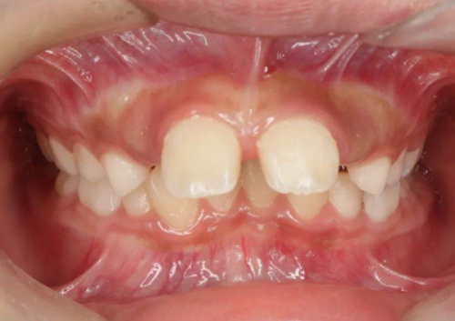 徐州亚伟口腔门诊部收费价格表/收费标准