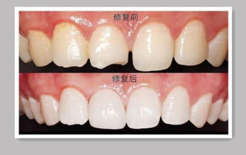 马盼盼医生技术优势