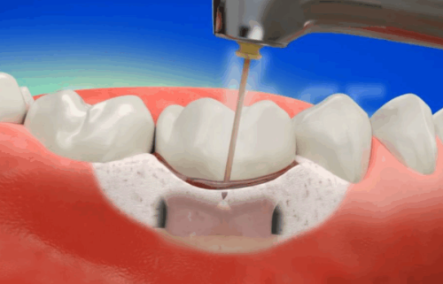 昆明安博口腔门诊部地址电话营业时间