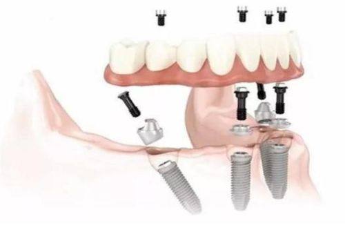 绵阳涪城倍诚熊猫口腔门诊部收费价格表/收费标准