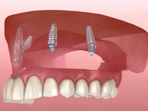 昆明安博口腔门诊部真人口碑评价怎么样？
