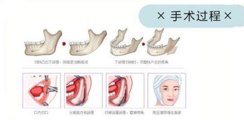 陕西省人民医院皮肤科地址电话营业时间