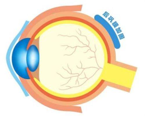 武汉市第六医院眼科是正规医院吗？
