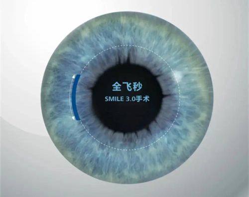 胡斌医生技术优势