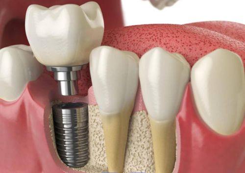 口碑评价及真人实例