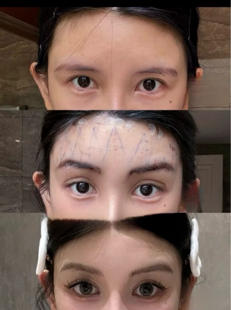 郑州美立方整形美容医院特色项目及技术优势