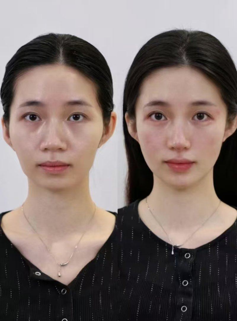 郑州美立方整形美容医院真人口碑评价怎么样？