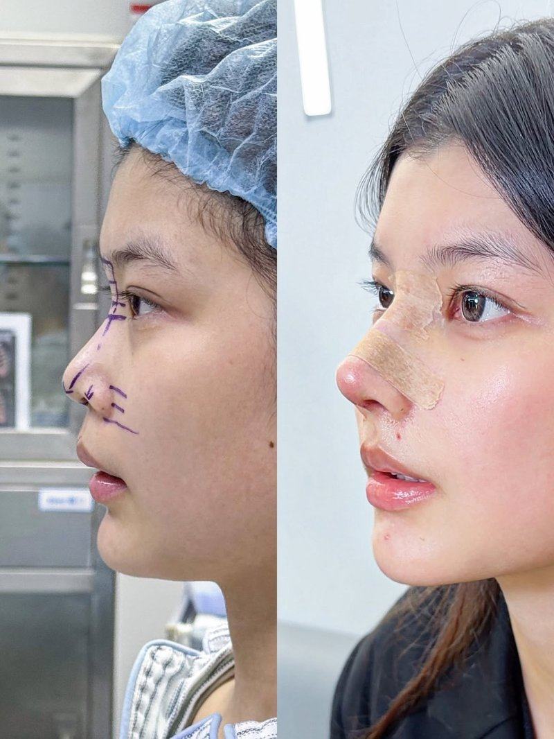 肇庆美创医疗美容门诊部收费价格表/收费标准