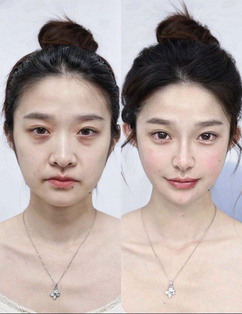 陕西省人民医院皮肤科特色项目及技术优势