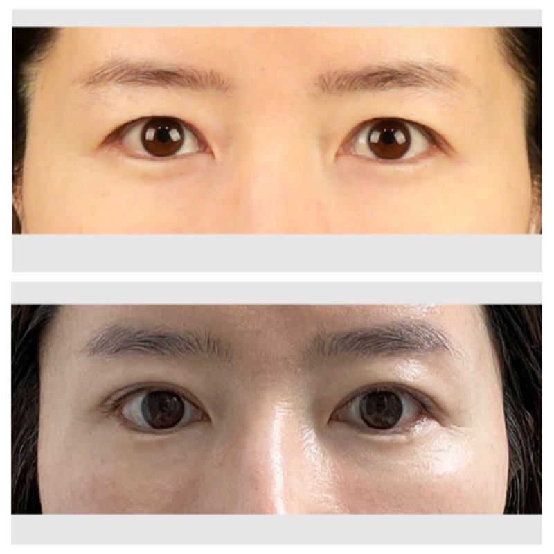 宁波邬立新医疗美容诊所收费价格表/收费标准