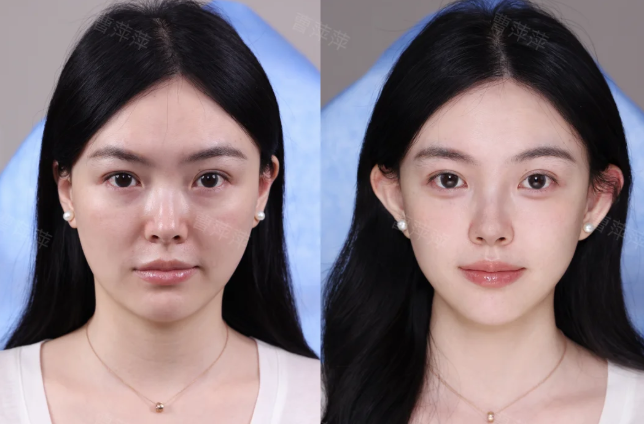 铁岭县中 心医院整形美容科详细的预约挂号方式及流程