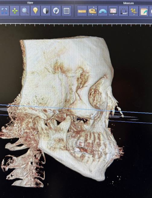 口碑评价及真人实例