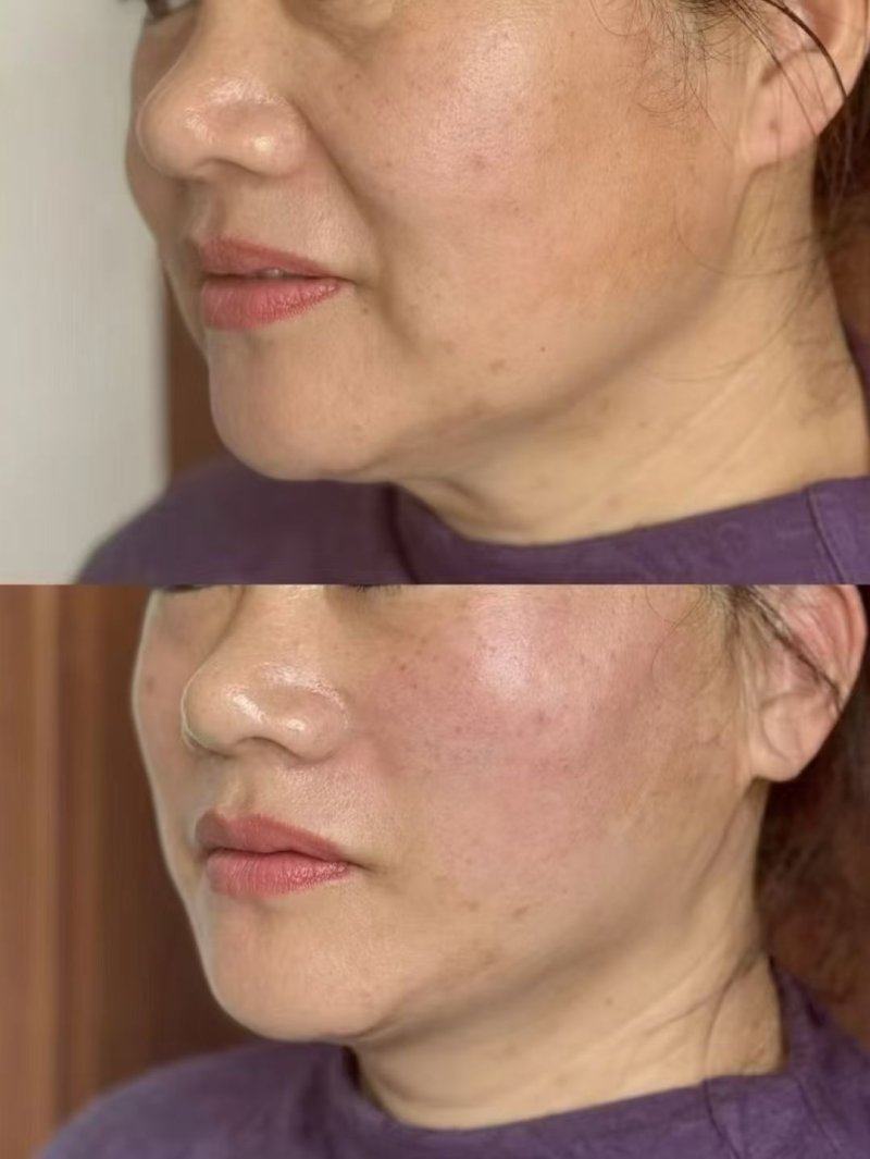 夏宏飞医生口碑评价及真人实例