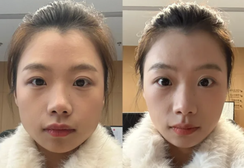 铁岭县中 心医院整形美容科特色项目及技术优势