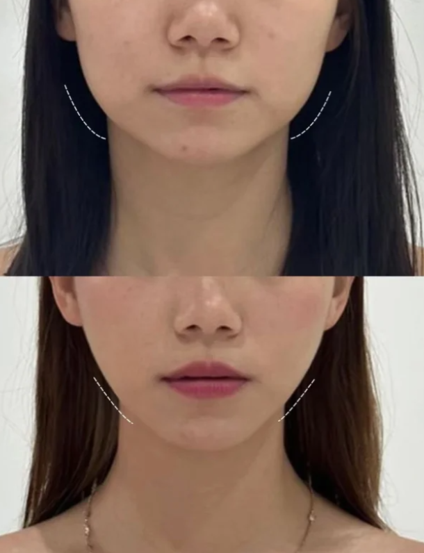 肇庆美创医疗美容门诊部真人口碑评价怎么样？