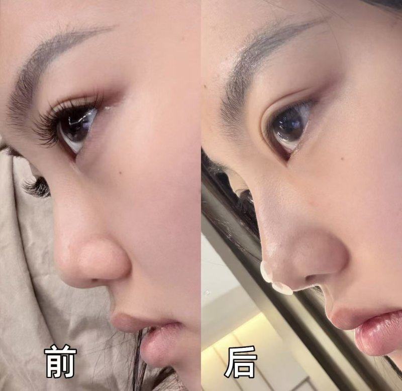 衢州熙妍医疗美容门诊部收费价格表/收费标准