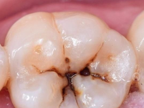 石家庄普爱口腔桥西门诊部收费价格表/收费标准