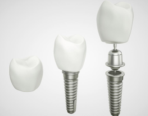 徐州安博口腔真人口碑评价怎么样？