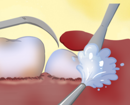 昆山美洁净口腔收费价格表/收费标准