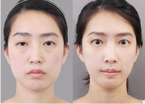 夏宏飞医生价格表