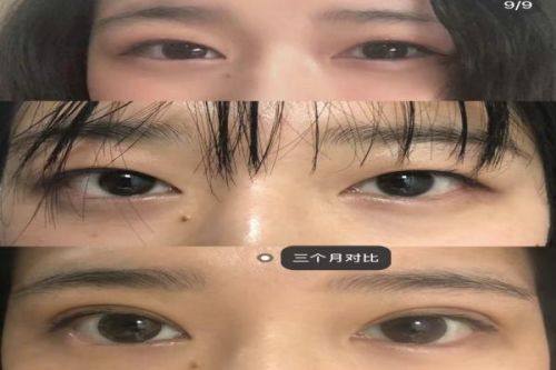 张久辉医生价格表