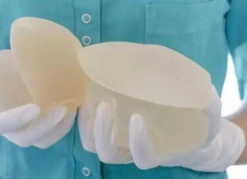 黄峰医生技术优势