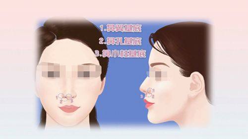 广州艾沫尔医疗美容诊所详细的预约挂号方式及流程