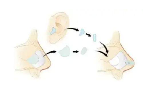 长春伊美整形医院真人口碑评价怎么样？