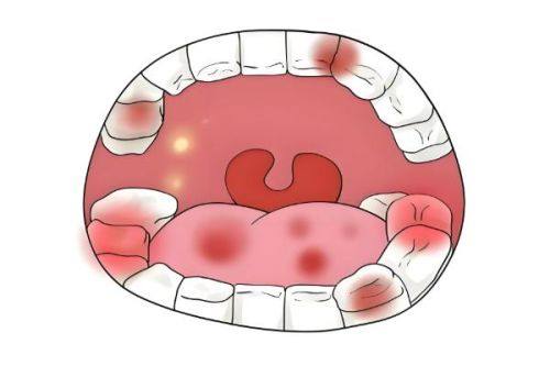湖南张家界医雅口腔详细的预约挂号方式及流程