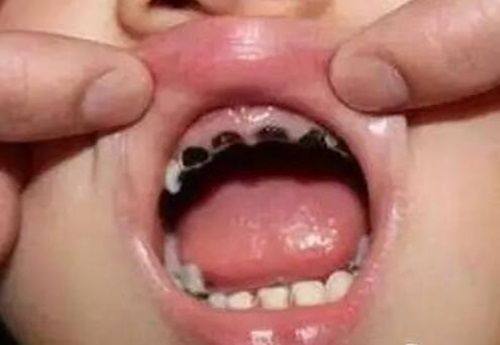 口碑评价及真人实例