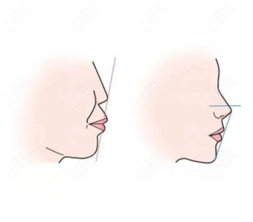 烟台圣牙贝南大街口腔门诊部详细的预约挂号方式及流程