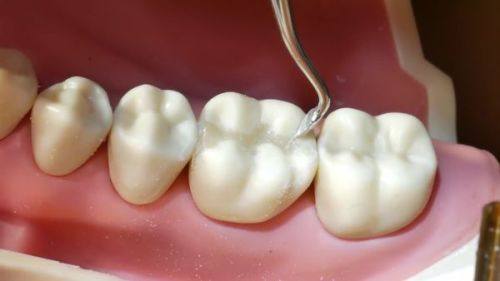 王朋娜医生技术优势