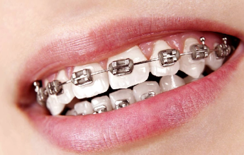 湖南张家界医雅口腔特色项目及技术优势