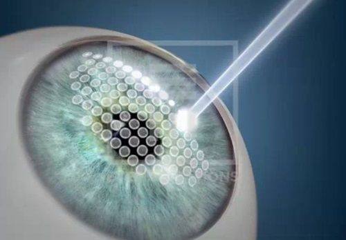 淮北矿工总医院眼科收费价格表/收费标准