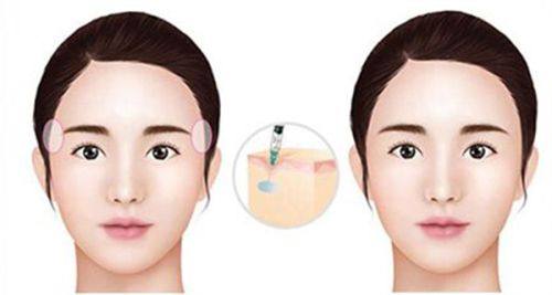 朵戈芙蒂医院明洞店真人口碑评价怎么样？