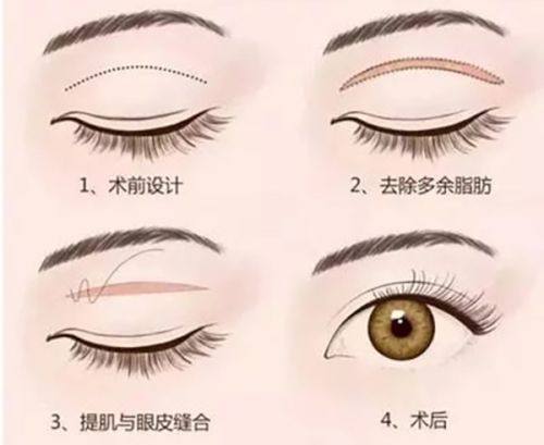 成都集佳整形医疗美容诊所是正规医院吗？