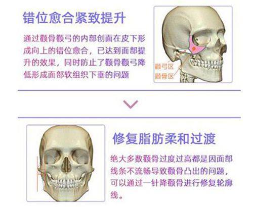 黄峰医生擅长项目