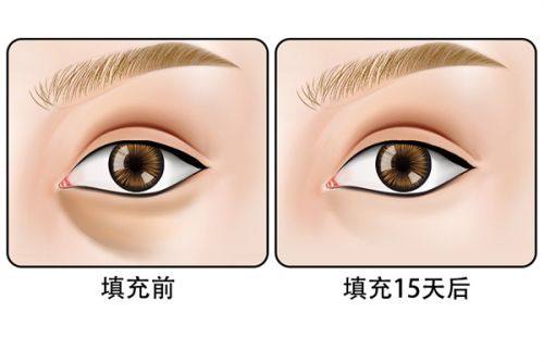 深圳美加美医疗美容整形门诊部是正规医院吗？