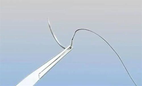 昆山东方美人整形医院是正规医院吗？