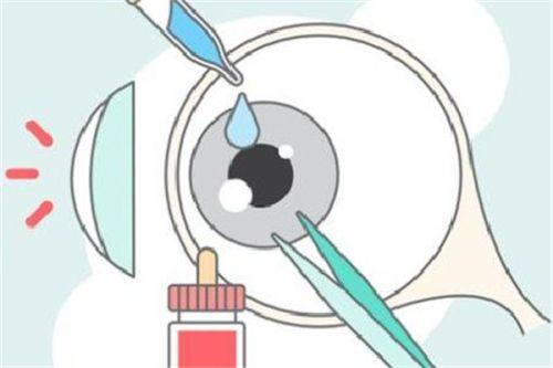 淮北矿工总医院眼科是正规医院吗？