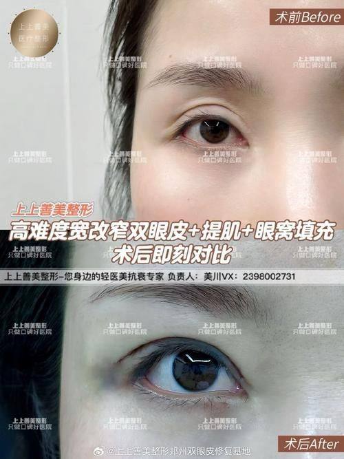 张久辉医生口碑评价及真人实例