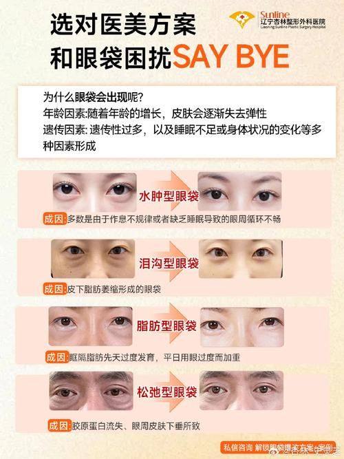 张久辉医生擅长项目