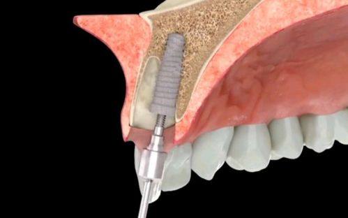 高念医生擅长项目